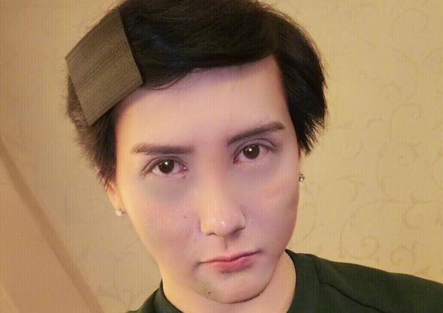 刘梓晨融掉玻尿酸脸垮了,补打了80针后长这样_芭比_样子_什么