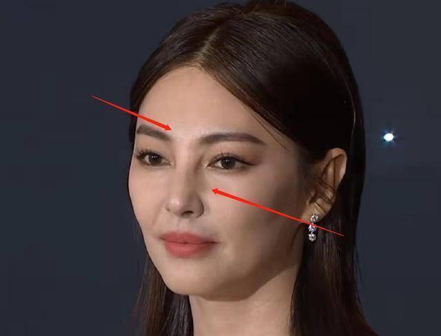 张雨绮短发造型出席红毯,脸僵被吐槽像机器人,网友喊话别再动脸_妈妈