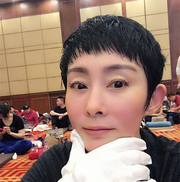 比起过去饱满的脸颊,现在的张敏无异于一张网红脸.