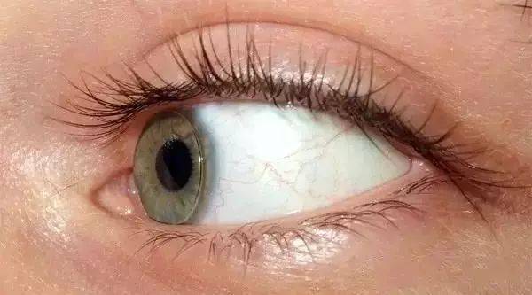 眼泪(泪液)是由泪腺,结膜杯状细胞分泌的透明稍带乳白色的水样液体,泪