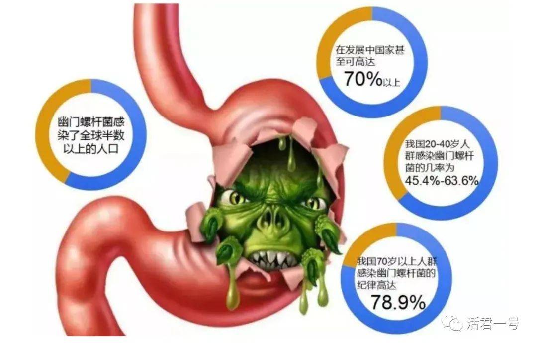 全家感染幽門螺桿菌,患有慢性胃炎,胃潰瘍,十二指腸潰瘍,可以吃活君