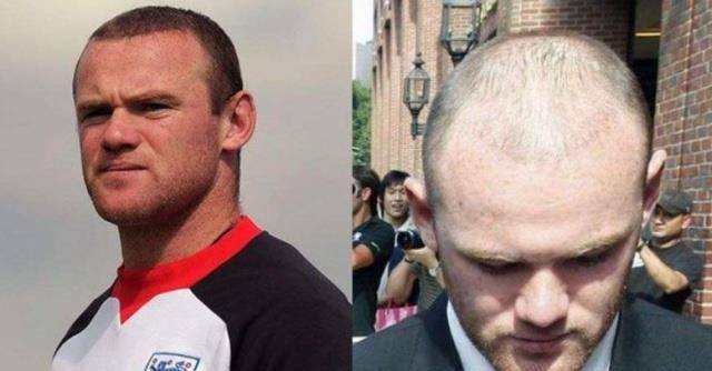 在曼联时期,c罗的队友鲁尼就是一个"脱发困难户".