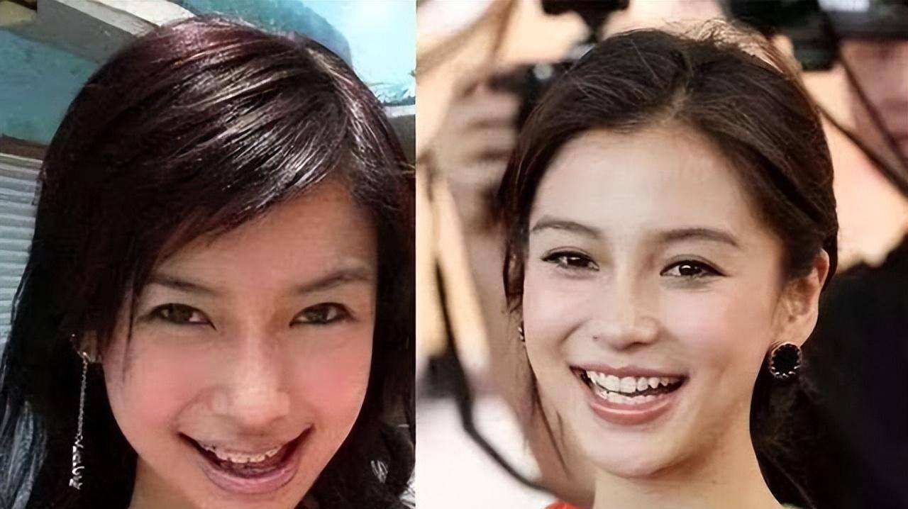 看看这些凸眼的女明星,年纪越大越明显_眼睛_孙俪_陈钰