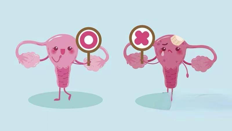 "巨阴症"是个啥?得上就不能生育了?