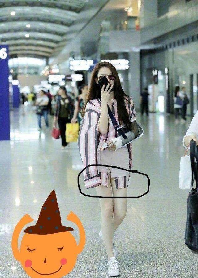 戚薇现身机场左臂再次骨折,综艺节目频发事故引人思考_受伤_团队_偶像