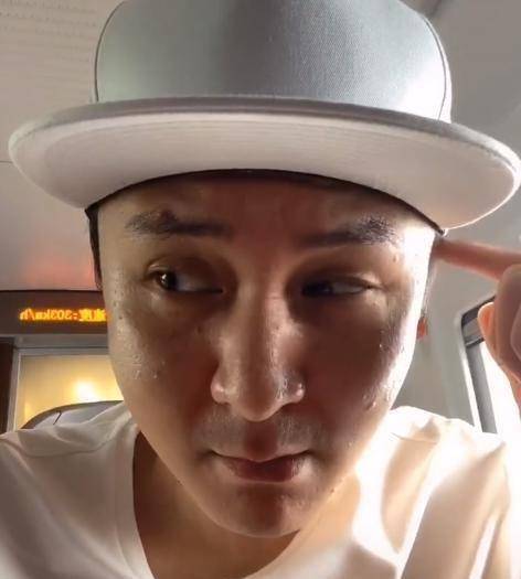 上海台名嘴晒近况发福明显,油光疙瘩满面认不出,41岁就老态初显_朱桢