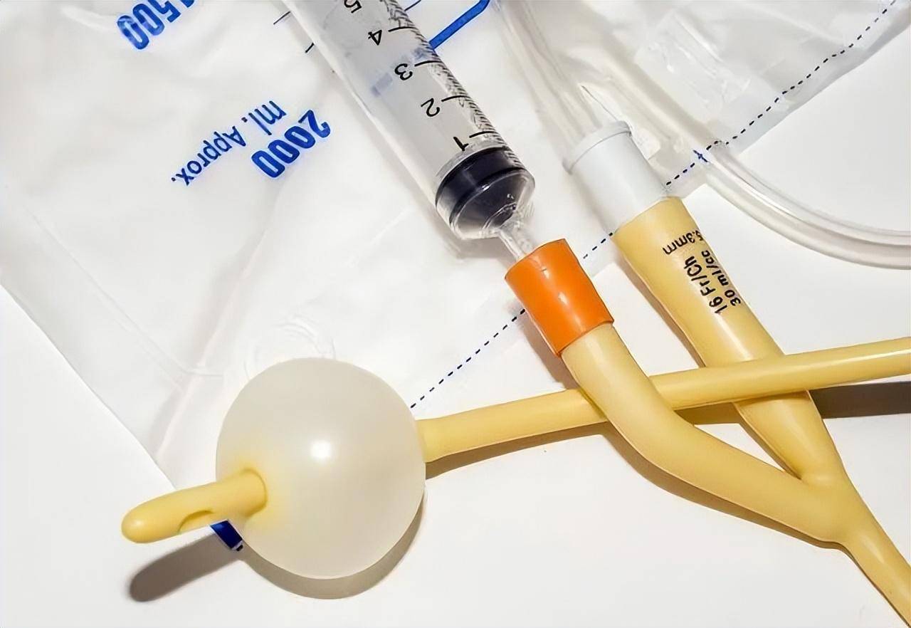 这几种情况考虑留置尿管,7种方法缓解不适_尿液_患者_导尿管