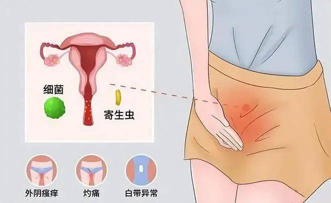 阴虱病图片女性图片