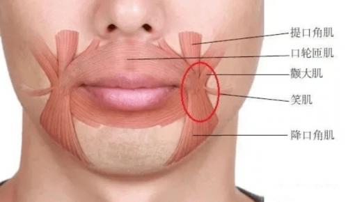 在放松状态下,降口角肌的静息力量相对过大是导致嘴角下垂的一个重要