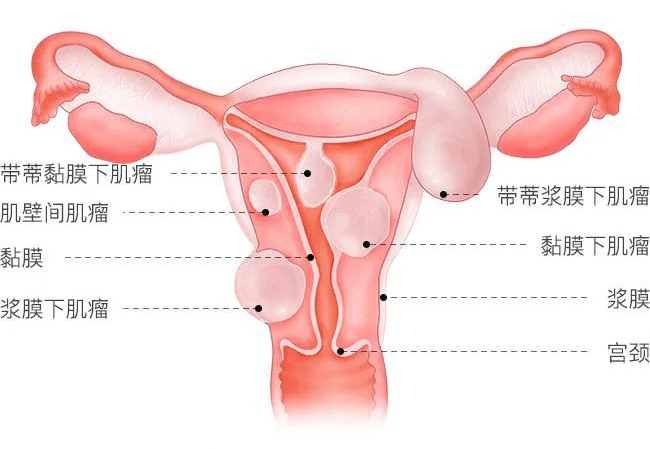 直肠把握子宫颈图片图片