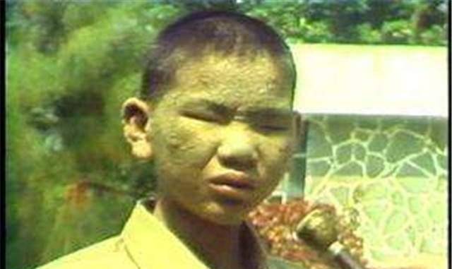 那一年,日本有1684人,因为误食了掺杂着多氯联苯的油而中毒.