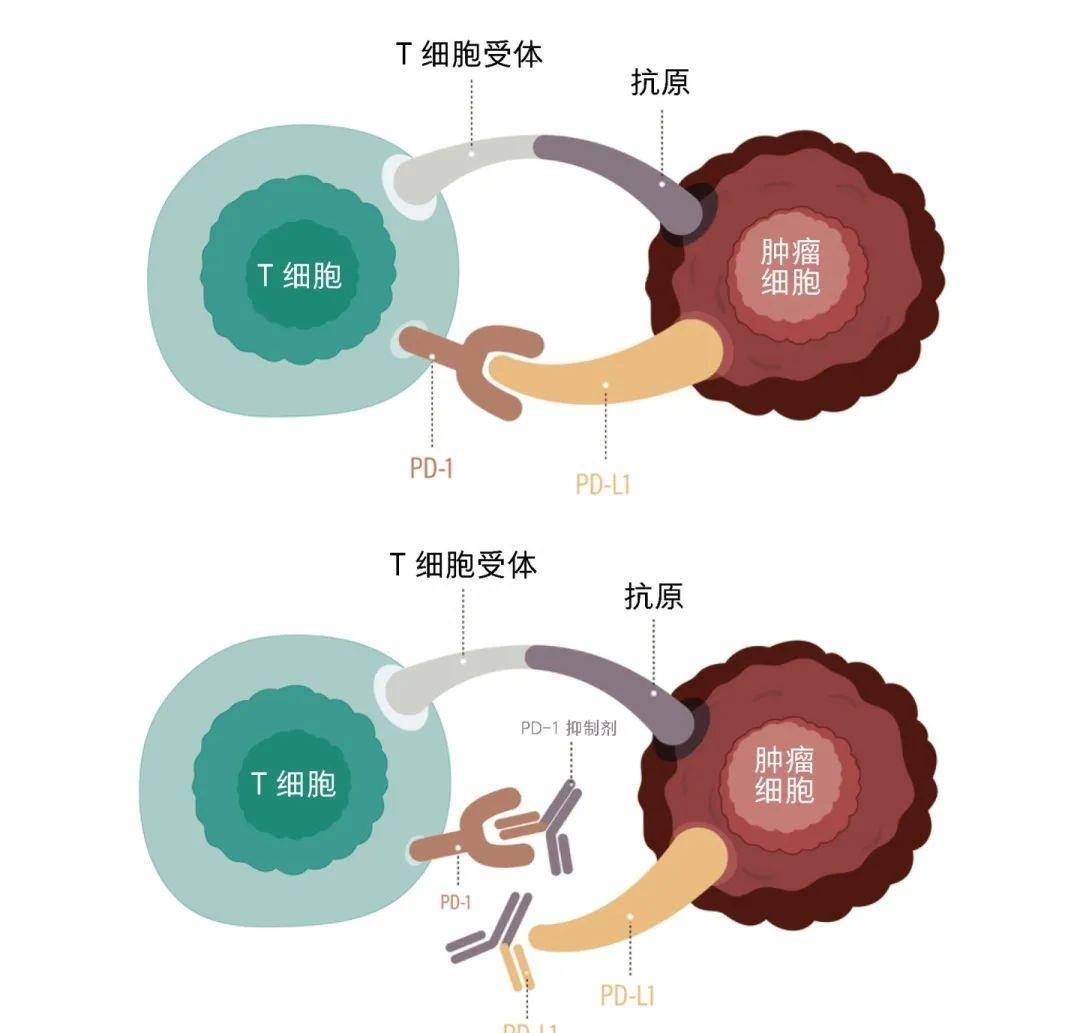 全病标志物:肿瘤免疫治疗疗效评估的新手段_标准_细胞_患者