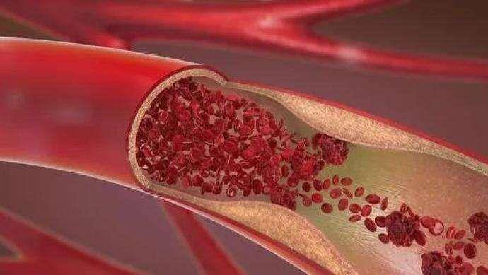 一氧化碳进入血液以后,会消耗掉氧气与红细胞增多营养物质,血液当中