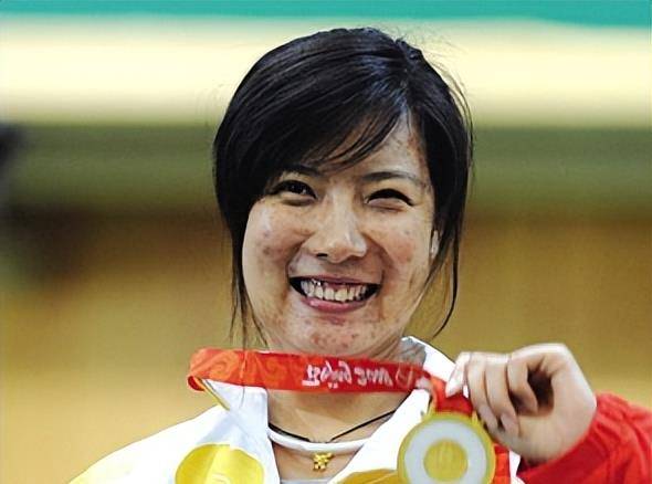 从满脸痘蜕变成颜值女神,如今年过40的奥运冠军杜丽,仍气质十足_痘痘