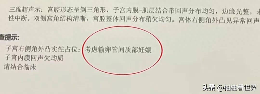 新鲜出炉（女朋友装怀孕测试男友）用怀孕试探男朋友 第6张