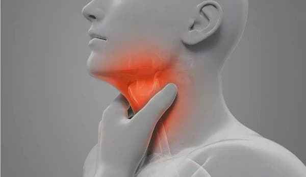 慢性咽喉炎症状图片