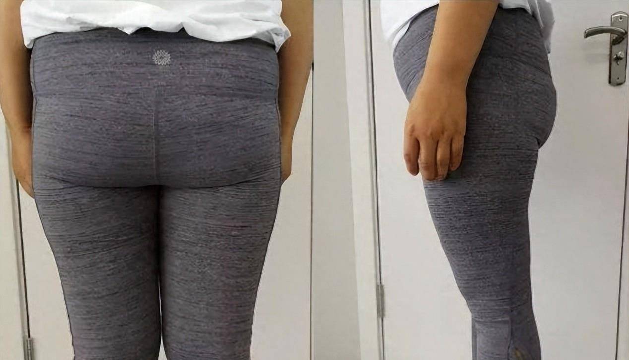 4步轻松练_臀部_骨盆_形状