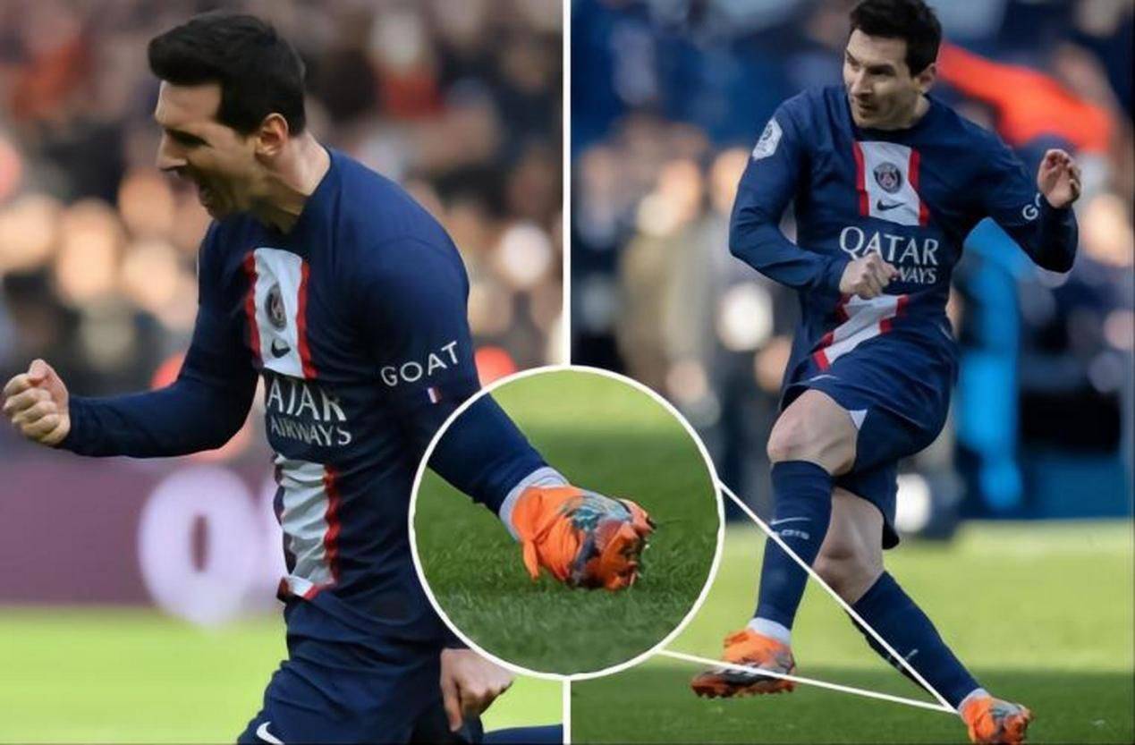 还有这么多年以来,梅西在比赛中脚踝被踩成90度,已经发生过不少次