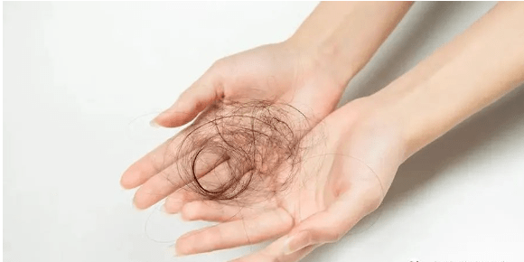 【长沙脱发专家挂号】女性大把大把掉头发,是什么原因?