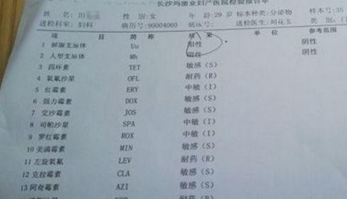 准妈妈在怀孕以后,可以在产检单子上看一下表开头的字母,如果说开头