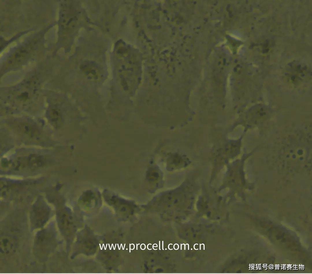 细胞学堂 | 如何判断细胞状态_形态_污染_显微镜