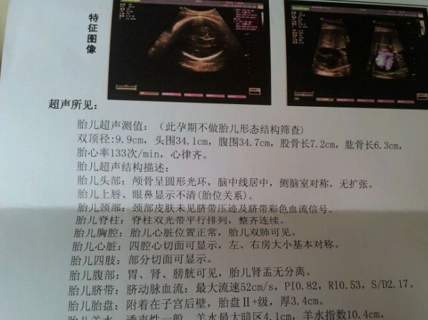 对于女生来说比较小一些,孕囊的话是用三个数据相乘来表示的,假如你