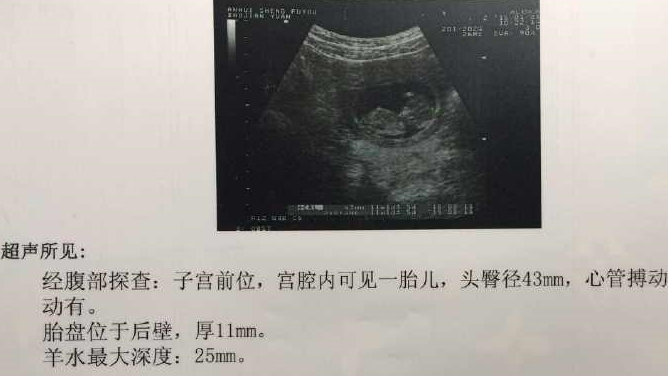在女性朋友怀孕以后,几乎每次产检的时候都会做b超,在b超单上会有一个