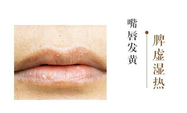 百草益寿:观唇色识健康 6种唇色反应身体不同问题 !_嘴唇_气血_食物