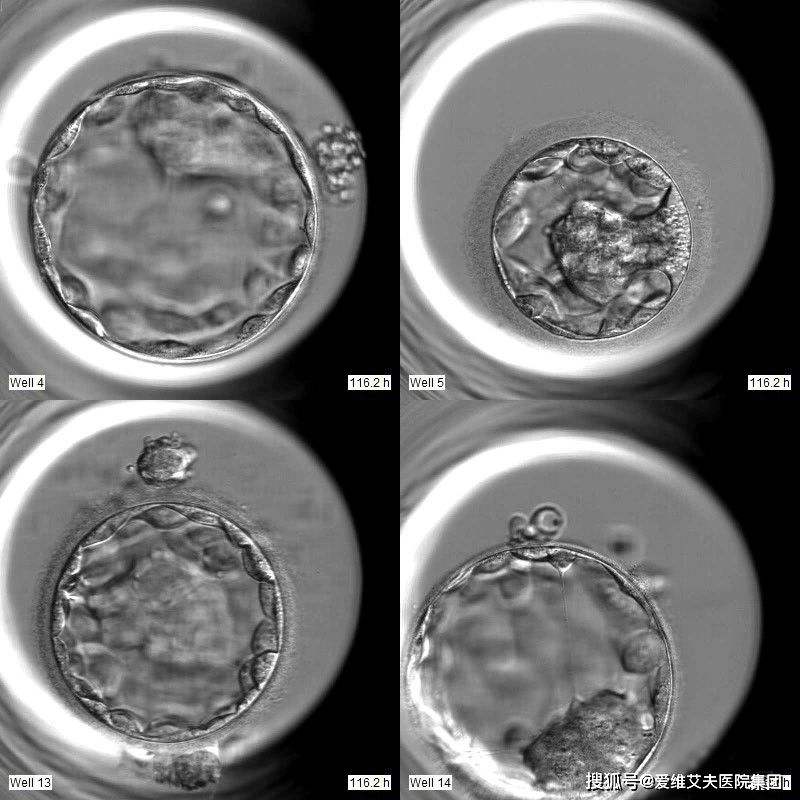 4aa囊胚图片图片