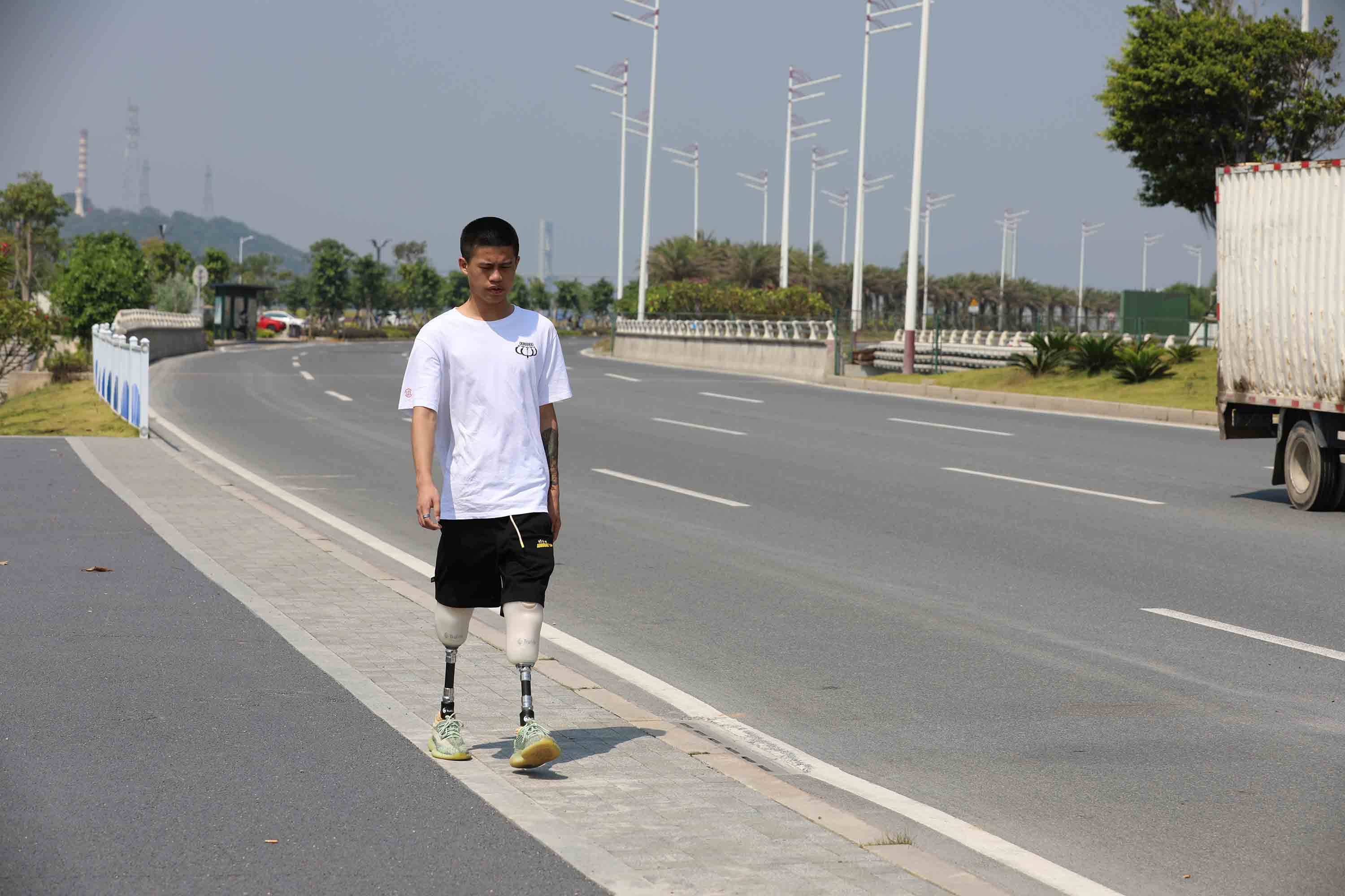 按压残肢端部有痛感怎么办?_情况_治疗_患者