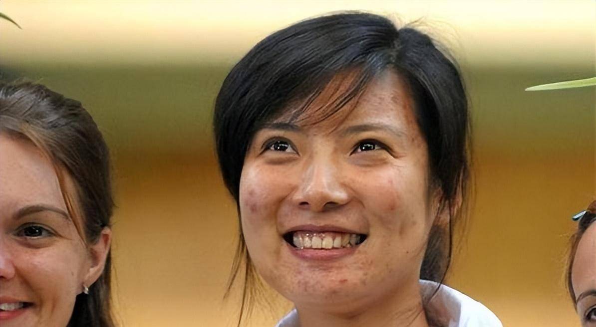 这样的变化让许多人感到惊讶,他们纷纷猜测杜丽是否整容.