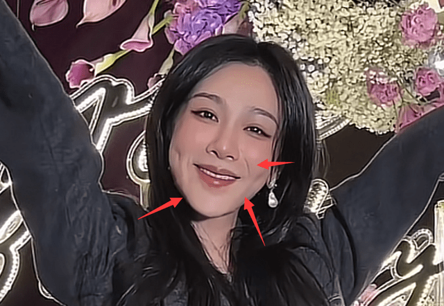 此外,可以看出如今杨紫山根部位衔接过度所以整个脸看上去不太流畅