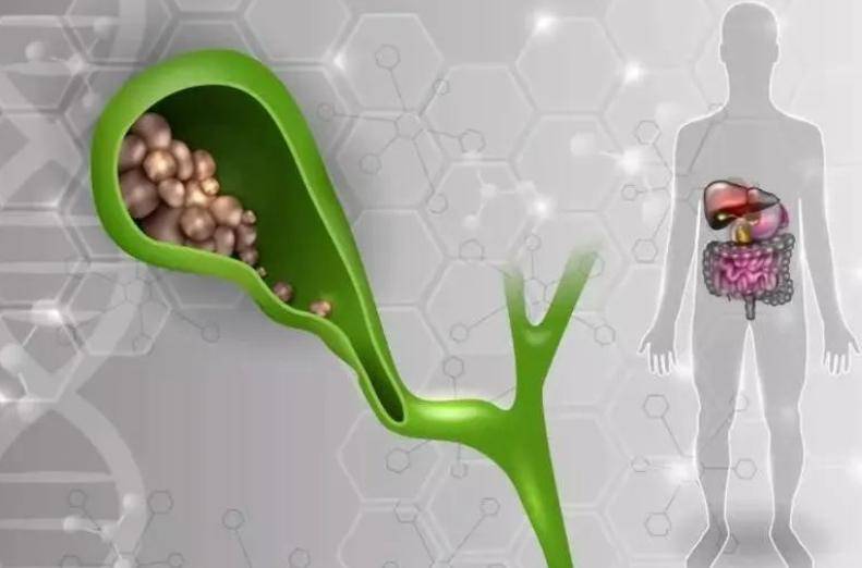 答案来了_胆汁_脂肪_建议