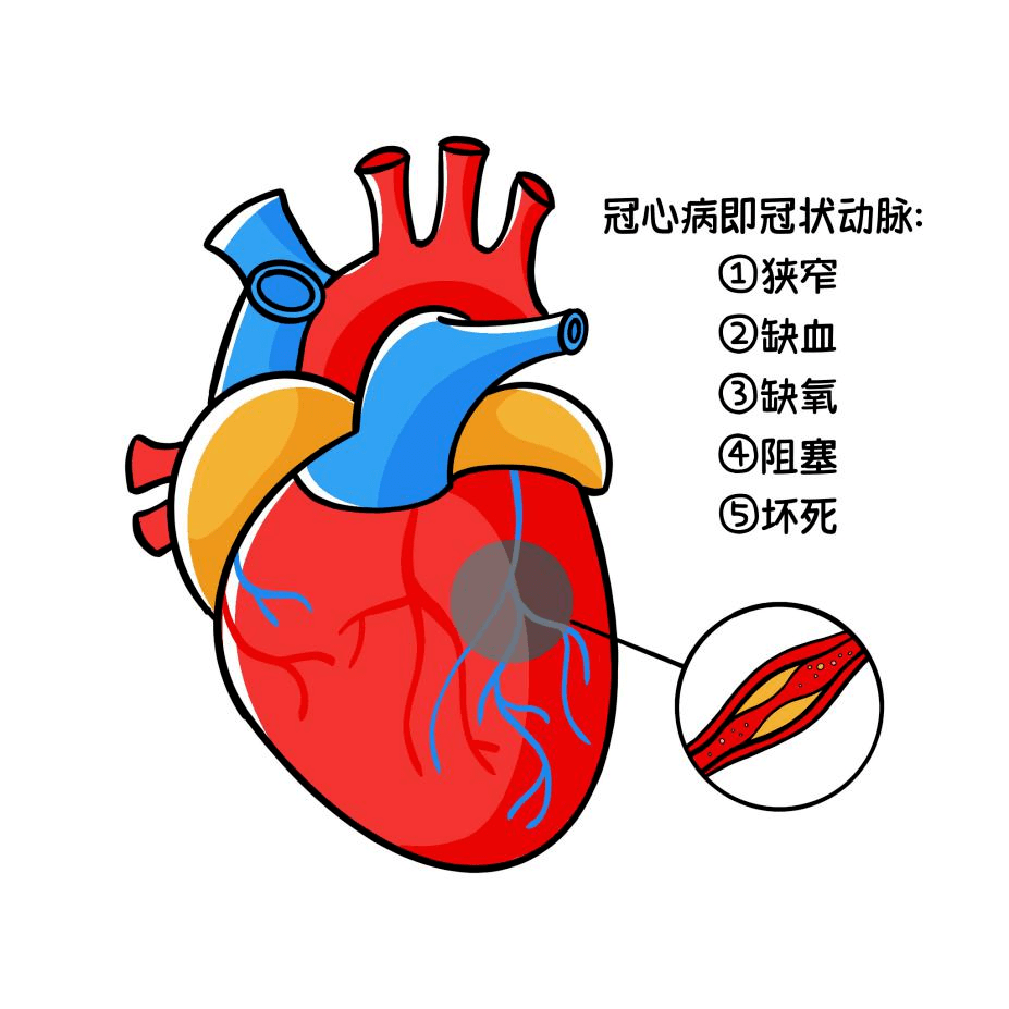冠状动脉_症状_心脏