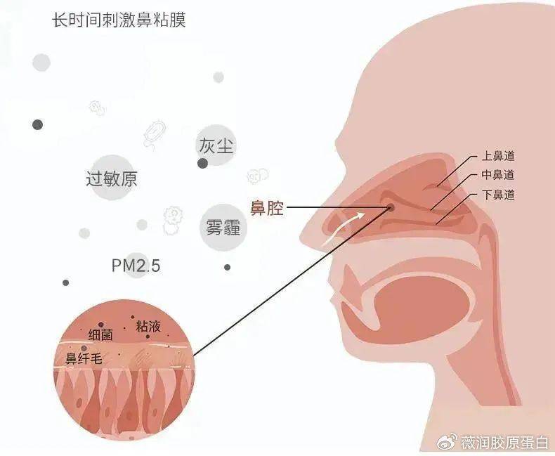 鼻患者鼻粘膜为什么一刺激就充血?重组Ⅲ型人源化胶原蛋白修复鼻粘膜