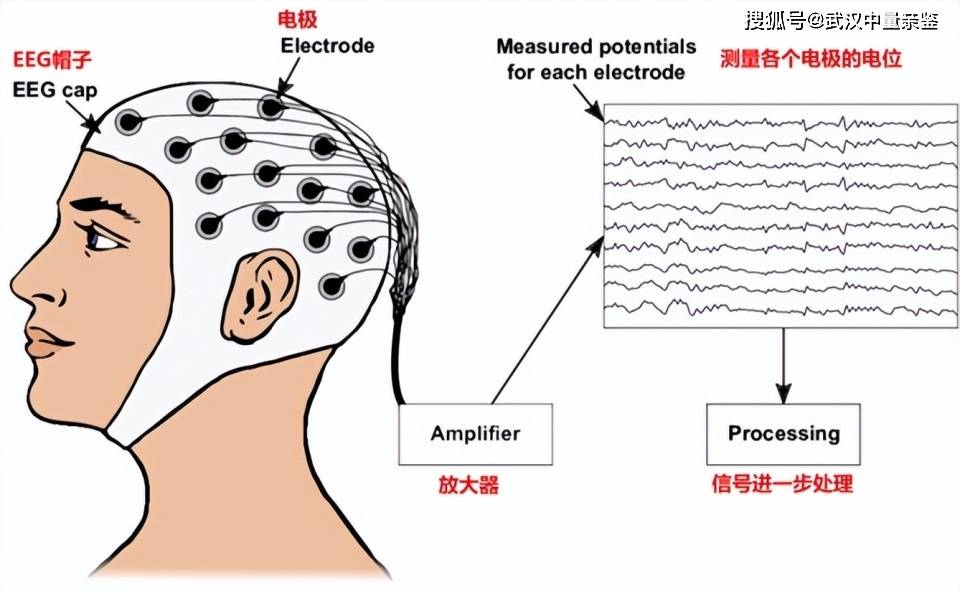 脑电图的定位方法图片