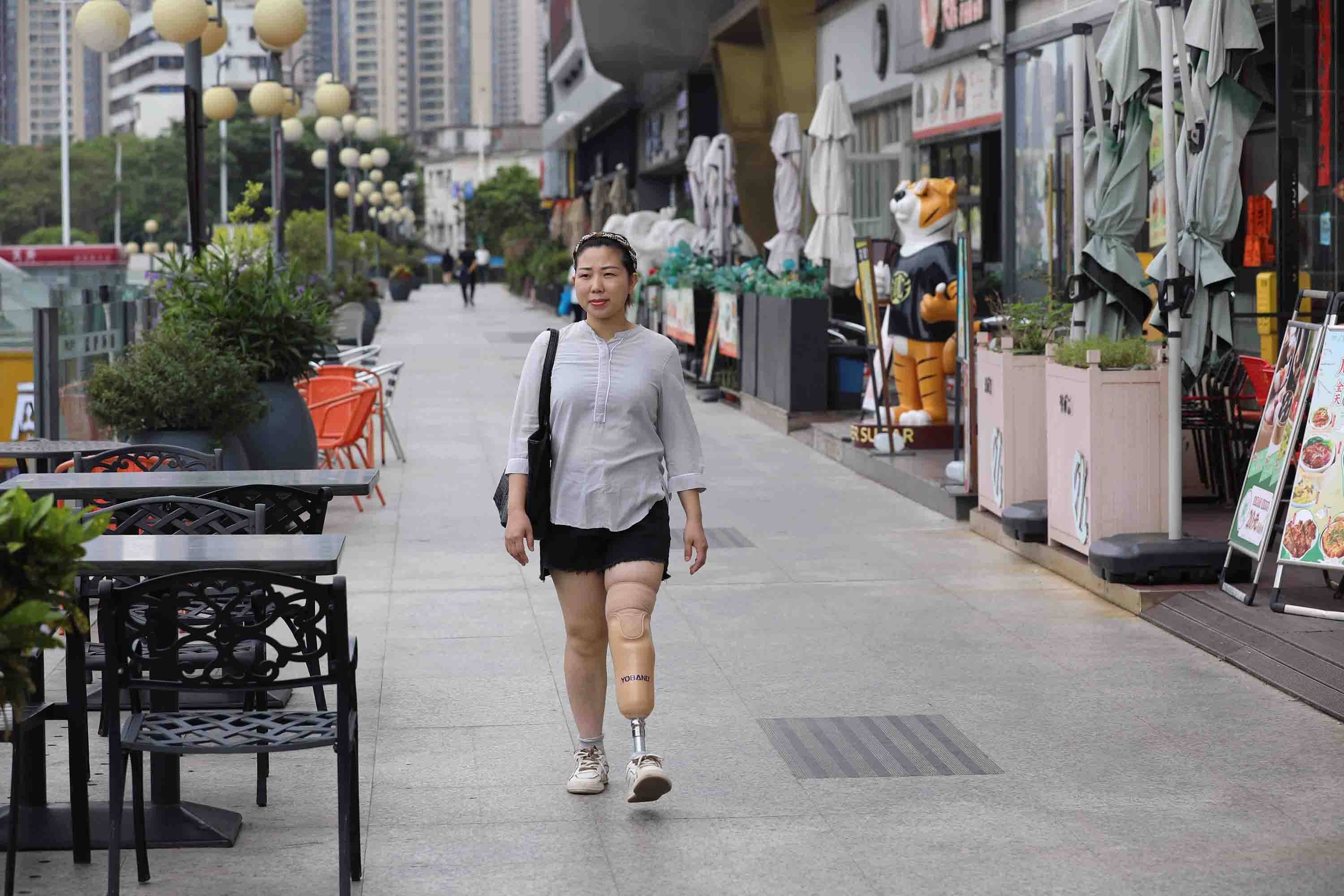 假肢安装后的心理康复治疗_残疾人_人员_系统