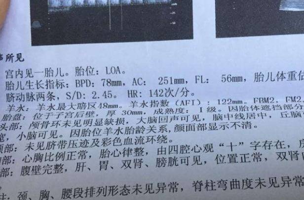 孕检时,若出现这4种"现象",也许孕妈怀"小阿哥"