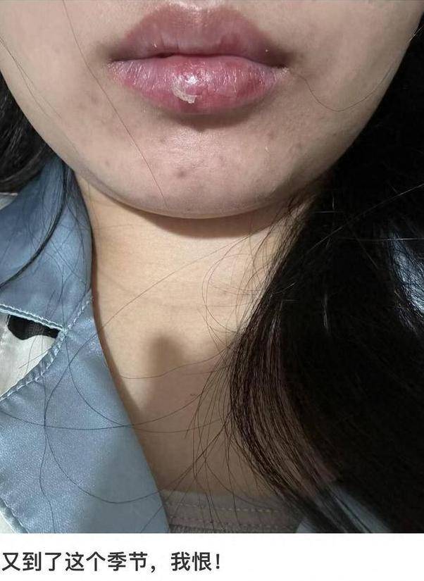 睡前涂润唇膏更有效吗?秋冬护唇:先纠正这两个坏习惯_嘴唇_成分_产品