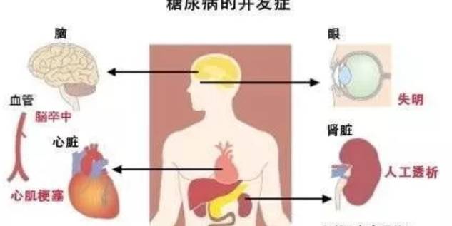 急性有糖尿病酮症酸中毒,高滲性昏迷,感染等;慢性併發症如糖尿病足