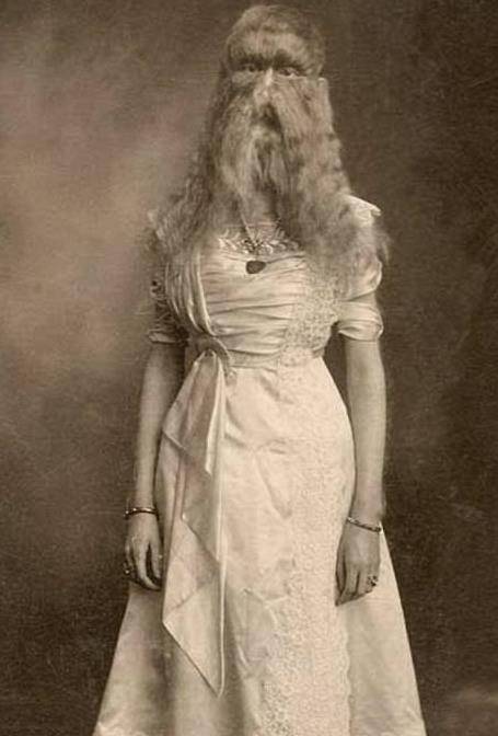 身高不足1米4的"多毛女":20多位商人向她求婚,只为利用她赚钱_朱莉娅