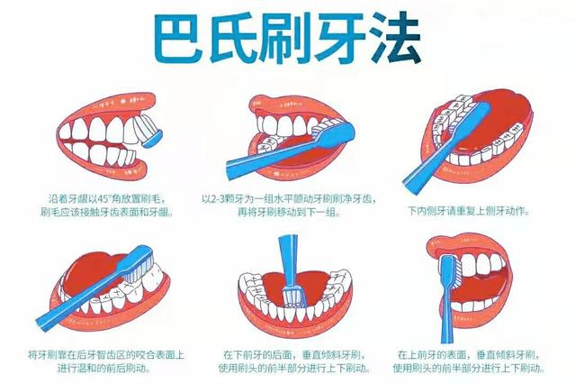 定期進行牙周潔治,目標是徹底清除菌斑,牙石等病原刺激物,消除牙齦的