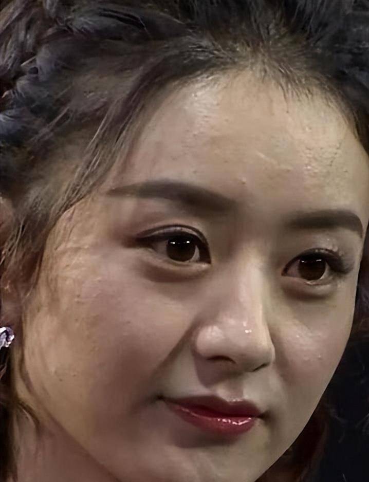 赵丽颖的毛孔,宋轶的黑头,没了滤镜这些明星彻底"暴露"了_皮肤_问题