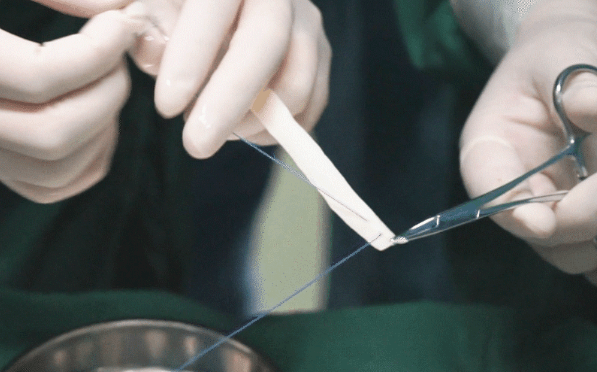 私密整复专家张红歌:3d生物束带紧缩术快问快答_花园_女性_生殖