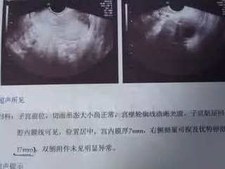 孕檢單上出現3個