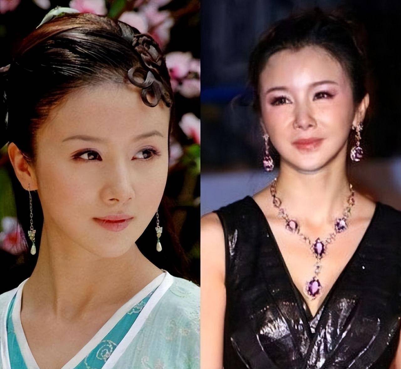 女星整容血泪史:娄艺潇成假面女王,鞠婧祎"换头"堪比教科书_张檬_陈