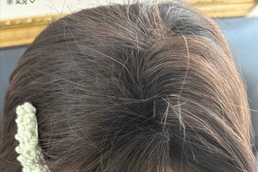 发质干枯,掉发巨多?用胱氨酸 一物,养出瀑布绸缎秀发!_压力_方法_按摩