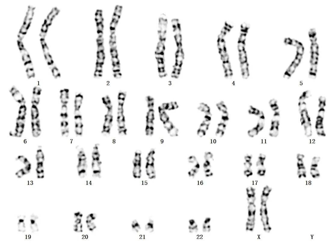 中国春染色体模式图图片