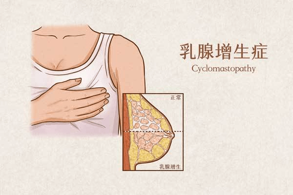 是由於女性內分泌失調——也就是雌激素增高,孕激素降低所造成的乳腺