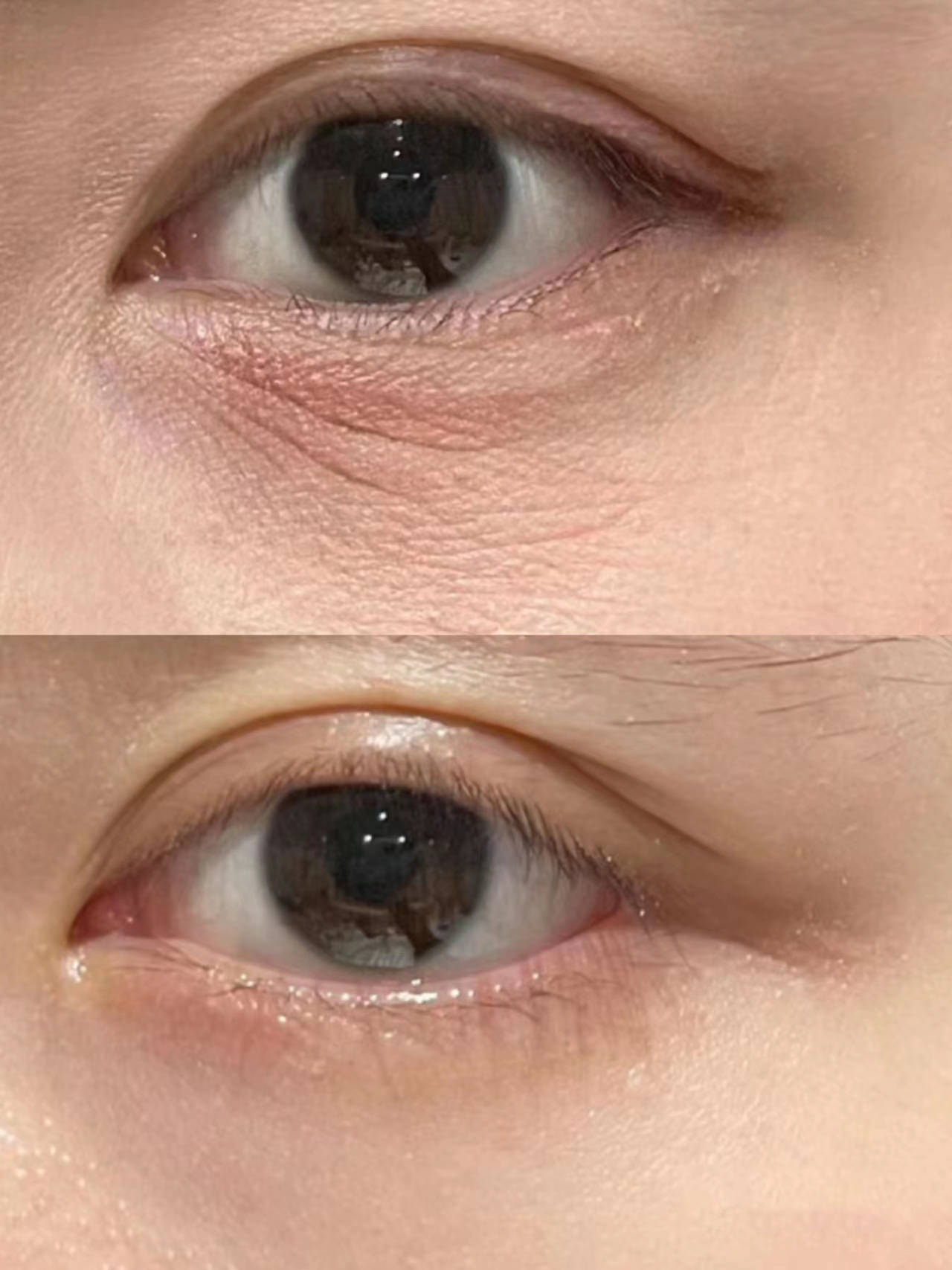 眼霜哪个牌子抗皱去皱效果最好?_肌肤_细纹_成分